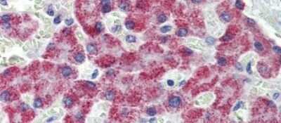 Immunohistochemistry-Paraffin: ACAA1 Antibody [NBP1-55156]