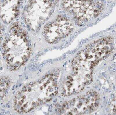 Immunohistochemistry-Paraffin: ACAA1 Antibody [NBP1-85786]