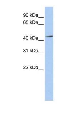 Western Blot: ACAA1 Antibody [NBP1-55156]