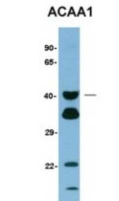 Western Blot: ACAA1 Antibody [NBP1-55156]