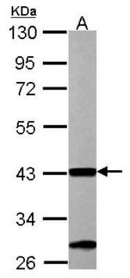 Western Blot: ACAA1 Antibody [NBP2-15233]