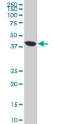 Western Blot: ACAA2 Antibody (2F7) [H00010449-M05]