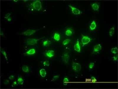 Immunocytochemistry/ Immunofluorescence: ACAA2 Antibody (5C4) [H00010449-M01]
