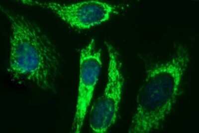 Immunocytochemistry/ Immunofluorescence: ACAA2 Antibody (OTI1C10) - Azide and BSA Free [NBP2-71602]