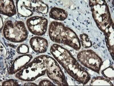 Immunohistochemistry: ACAA2 Antibody (OTI1C10) - Azide and BSA Free [NBP2-71602]