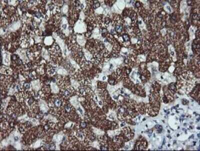 Immunohistochemistry: ACAA2 Antibody (OTI1C10) - Azide and BSA Free [NBP2-71602]