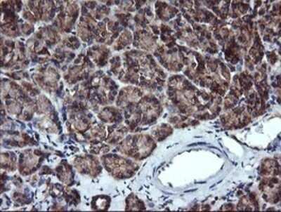 Immunohistochemistry: ACAA2 Antibody (OTI1C10) - Azide and BSA Free [NBP2-71602]