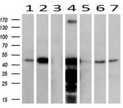 Western Blot: ACAA2 Antibody (OTI1C10)Azide and BSA Free [NBP2-71602]