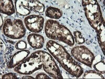 Immunohistochemistry: ACAA2 Antibody (OTI1C10) [NBP2-46477]