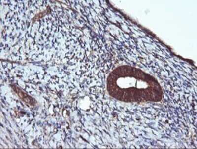 Immunohistochemistry: ACAA2 Antibody (OTI1C10) [NBP2-46477]