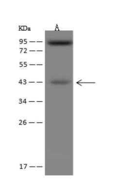 Western Blot: ACAA2 Antibody [NBP3-06401]