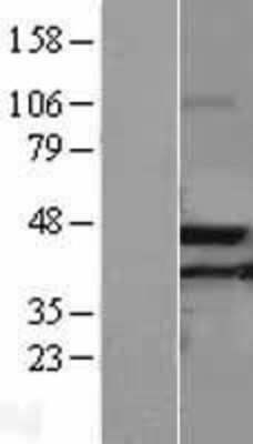 Western Blot: ACAA2 Overexpression Lysate [NBL1-07217]
