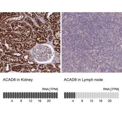 Immunohistochemistry-Paraffin: ACAD8 Antibody [NBP2-47559]