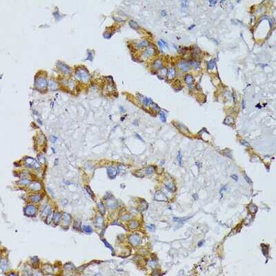 Immunohistochemistry-Paraffin: ACADL Antibody - BSA Free [NBP2-92854]