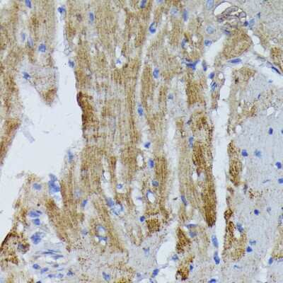 Immunohistochemistry-Paraffin: ACADL Antibody - BSA Free [NBP2-92854]