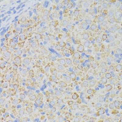 Immunohistochemistry-Paraffin: ACADL Antibody - BSA Free [NBP2-92854]