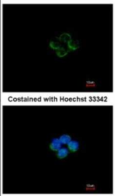 Immunocytochemistry/ Immunofluorescence: ACADM Antibody [NBP1-32028]