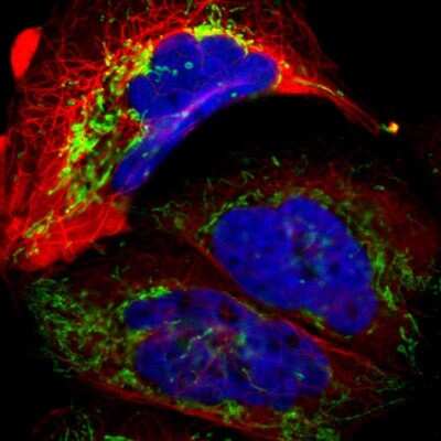 Immunocytochemistry/ Immunofluorescence: ACADM Antibody [NBP1-89292]