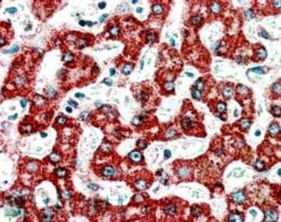 Immunohistochemistry-Paraffin: ACADM Antibody [NB100-1121]