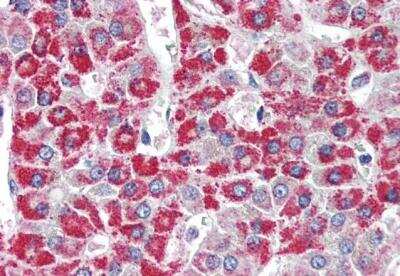Immunohistochemistry-Paraffin: ACADM Antibody [NB100-1121]