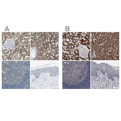 Immunohistochemistry-Paraffin: ACADM Antibody [NBP1-89292]