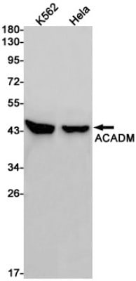 Western Blot: ACADM Antibody (S06-8F7) [NBP3-19554]