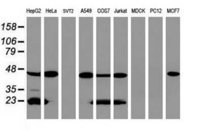 Western Blot: ACADS Antibody (OTI1D2) [NBP2-45474]