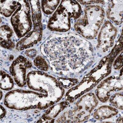 Immunohistochemistry-Paraffin: ACADS Antibody [NBP1-89290]