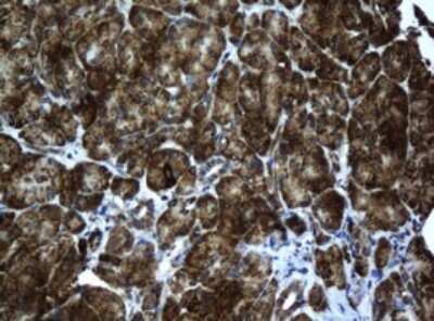 Immunohistochemistry: ACADS Antibody (OTI1D2) - Azide and BSA Free [NBP2-70061]