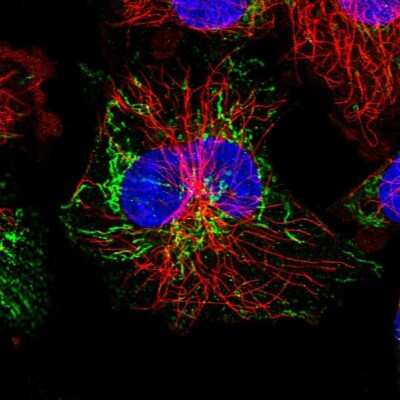 Immunocytochemistry/ Immunofluorescence: ACADSB Antibody [NBP2-48739]
