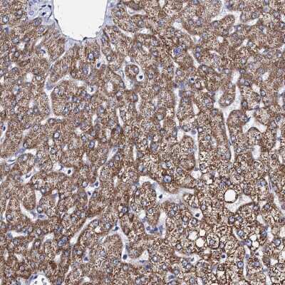 Immunohistochemistry-Paraffin: ACADSB Antibody [NBP2-48739]