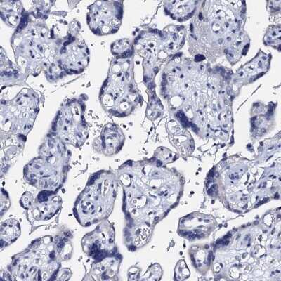 Immunohistochemistry-Paraffin: ACADSB Antibody [NBP2-48739]
