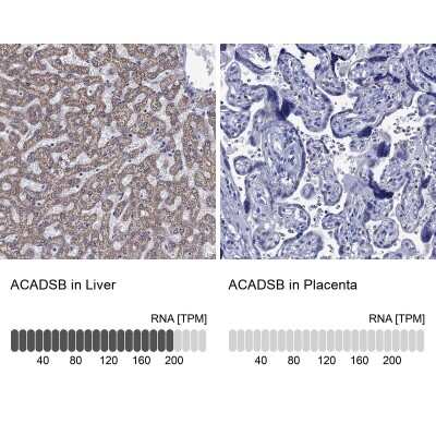 Immunohistochemistry-Paraffin: ACADSB Antibody [NBP3-17009]
