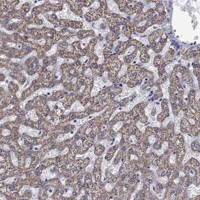 Immunohistochemistry-Paraffin: ACADSB Antibody [NBP3-17009]