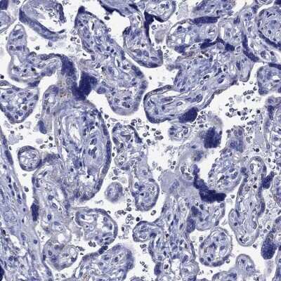 Immunohistochemistry-Paraffin: ACADSB Antibody [NBP3-17009]