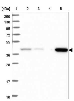 Western Blot: ACADSB Antibody [NBP2-48739]
