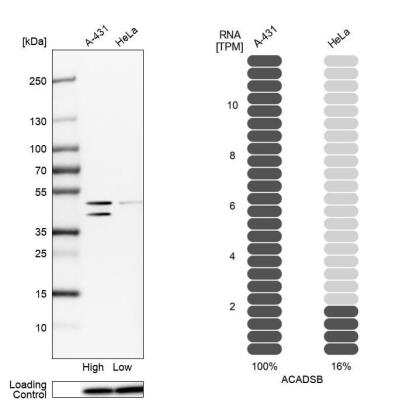 Western Blot: ACADSB Antibody [NBP2-48739]