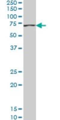 Western Blot: ACADVL Antibody (5D3) [H00000037-M01]