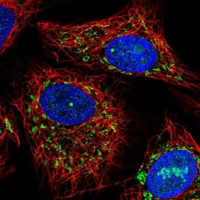 Immunocytochemistry/ Immunofluorescence: ACADVL Antibody [NBP1-89287]