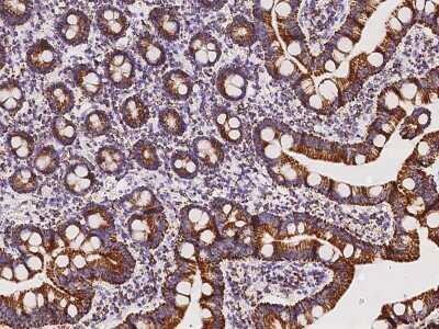 Immunohistochemistry-Paraffin: ACADVL Antibody [NBP2-97501]