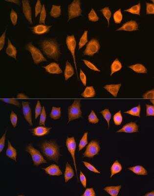 Immunocytochemistry/ Immunofluorescence: SOAT1 Antibody - BSA Free [NBP2-92471]