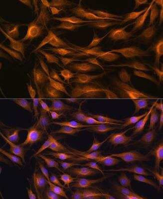 Immunocytochemistry/ Immunofluorescence: SOAT1 Antibody - BSA Free [NBP2-92471]