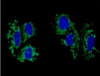 Immunocytochemistry/ Immunofluorescence: ACAT1 Antibody (2C5) - BSA Free [NBP2-22565]