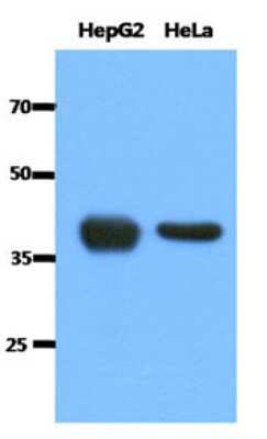 Western Blot: ACAT1 Antibody (2C5)BSA Free [NBP2-22565]