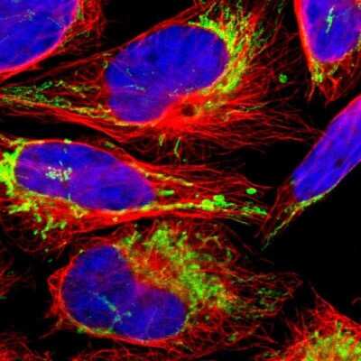 Immunocytochemistry/ Immunofluorescence: ACAT1 Antibody [NBP1-89284]