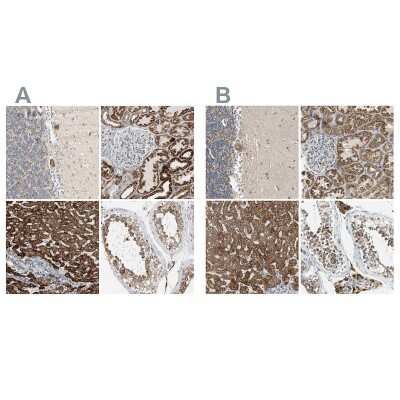 Immunohistochemistry-Paraffin: ACAT1 Antibody [NBP1-89285]