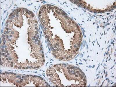 Immunohistochemistry-Paraffin: ACAT2 Antibody (OTI3E2) [NBP2-02588]