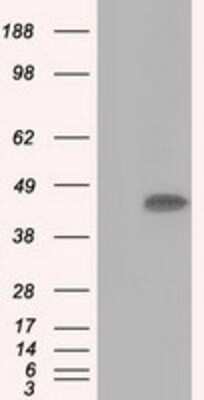 Western Blot: ACAT2 Antibody (OTI3E2) [NBP2-02588]