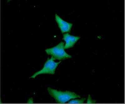 Immunocytochemistry/ Immunofluorescence: ACAT2 Antibody (55D5) - BSA Free [NBP2-42614]