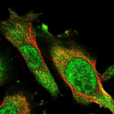 Immunocytochemistry/ Immunofluorescence: ACAT2 Antibody [NBP1-89526]